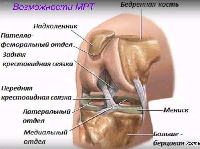 мрт суставов что показывает, почему мрт
