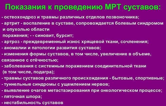 Что могут современные аппараты МРТ