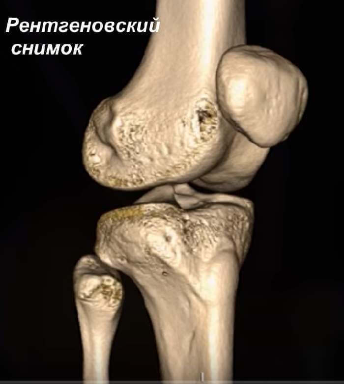 Рентгеновский снимок