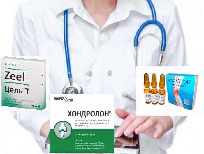 как отличить артроз от артрита