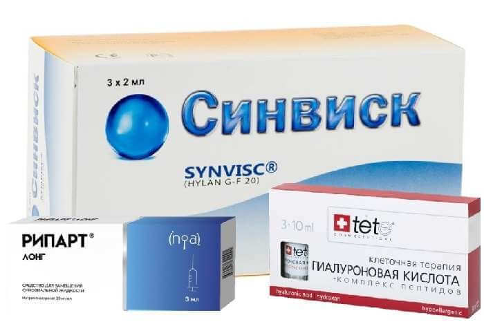 методы лечения гонартроза